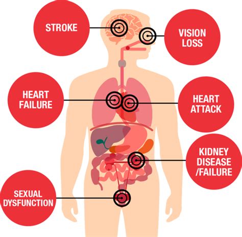 Cardiovascular Disease Symptoms And Treatment An Indepth List