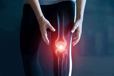 Knee Joint Replacement Infections Ozorthopaedics Melbourne