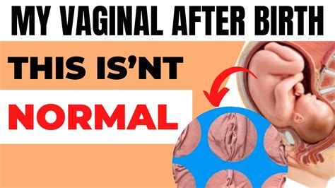 Changes To Vaginal After Birth How To Tighten Your Vaginal After