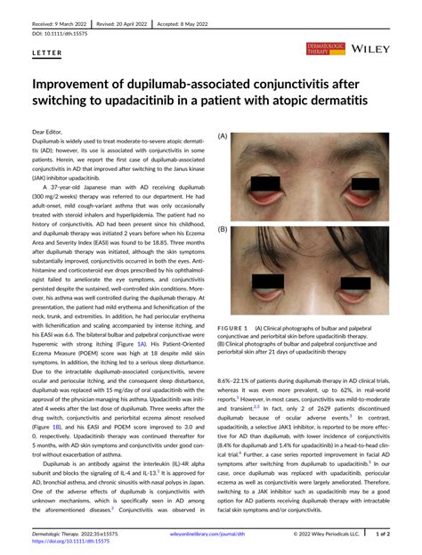 Improvement Of Dupilumab‐associated Conjunctivitis After Switching To
