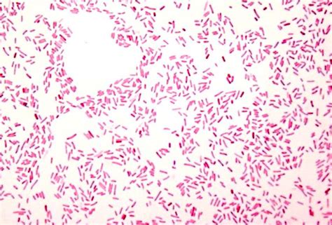 But no matter how cautious you are around your leather couch or chairs, you're living life on and near them, meaning the occasional stain is inevitable. Experiments 2 & 3 - Media & Staining - Microbiology ...