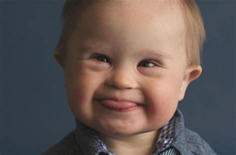 Baby With Down Syndrome Gets Modeling Gig After Agency Rejection