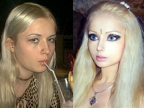 Валерия Лукьянова до и после пластики фото живой Барби 300 экспертов РУ