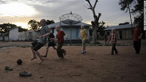 Malawis Albinos At Risk Of Total Extinction Un Warns Cnn