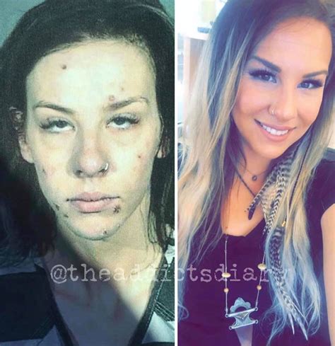 ‘the Addicts Diary Showcases Before And After Transformations Of People