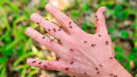 How To Treat Ant Bites Naturally Youtube