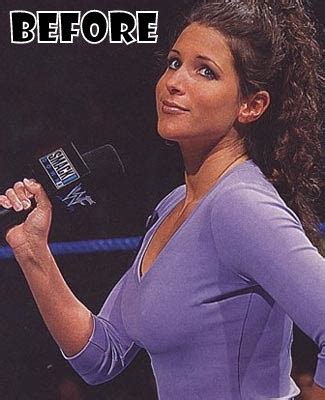 Stephanie McMahon Plastic Surgery Before And After Breast Implants Photos
