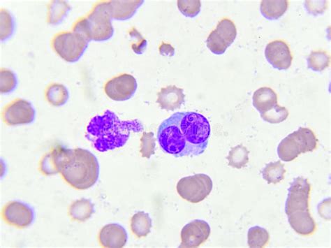 White Blood Cells Under Microscope Labeled