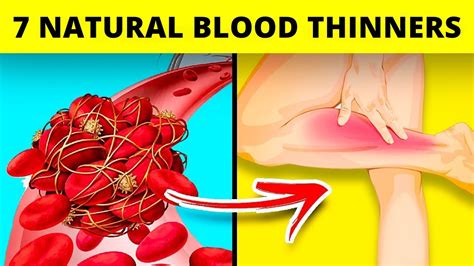 The 7 Best Natural Blood Thinners Natural Blood Thinning Youtube