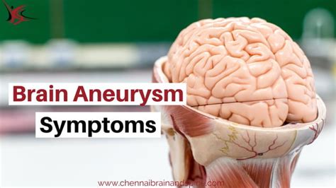Aneurysm Early Signs And Symptoms