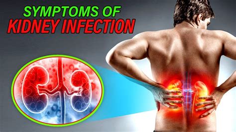 Kidney Pain Location Symptoms Causes Diagnosis Treatm