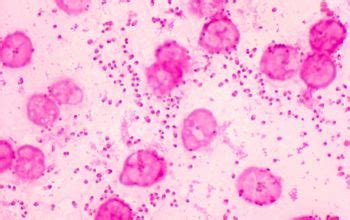Now, pasteurella multocida has a thin peptidoglycan layer, so it doesn't retain the crystal violet dye during gram staining. Pasteurella multocida