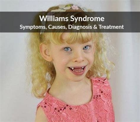 Williams Syndrome Symptoms Causes Diagnosis And Treatment