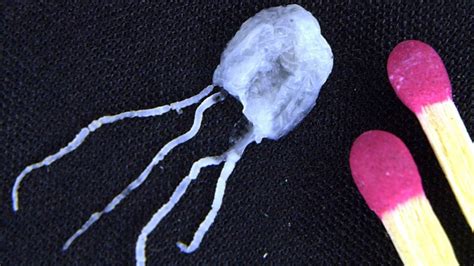 A Teenage Boy Has Died In Hospital After Being Stung By A Box Jellyfish