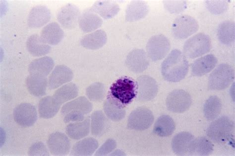 Free Picture Thin Film Micrograph Plasmodium Vivax Microgametocyte