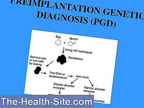 Preimplantation Genetic Diagnosis Application And Risks 💊 Scientific