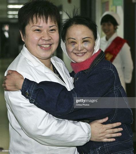 Chinese Woman Zhang Jing Known As The Ugly Girl Hugs The Doctor News Photo Getty Images