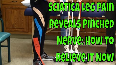 Sciatica Leg Pain Reveals Pinched Nerve How To Relieve It Now