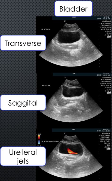 Ultrasound Basics — Taming The Sru