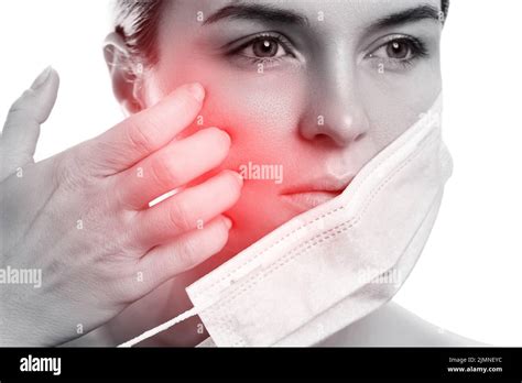 Maskne Acne Breakouts From Wearing A Face Mask Stock Photo Alamy