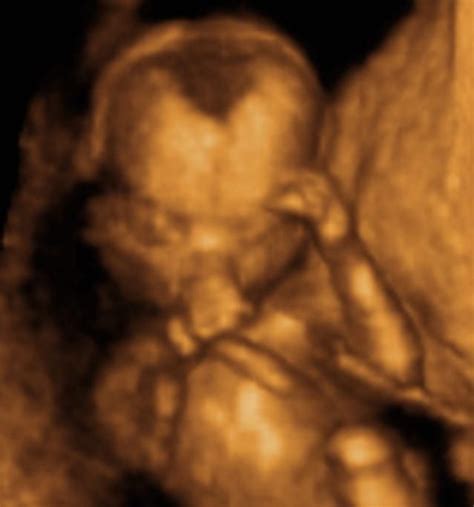 16th Week Ultrasounds Pregnancy Ultrasound 3d Ultrasound And Pregnancy