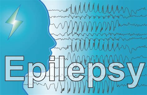 Epilepsie Information FÜr Patienten The Basics Neurologie Afradi