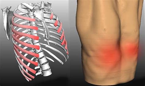 Have You Got Muscles Outside Rib Cage Do You Experience Muscle Spasms