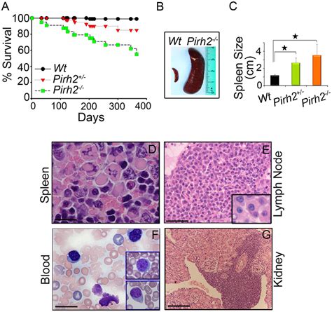 Shorter Life Span And Plasma Cell Hyperplasia Of Pirh2 Mutant Mice A