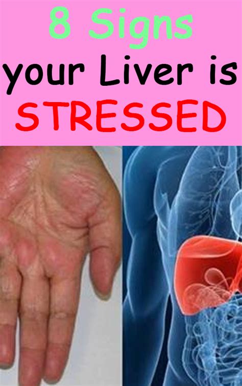 Do You Need A Detox 8 Signs Your Liver Is Stressed Hello Healthy