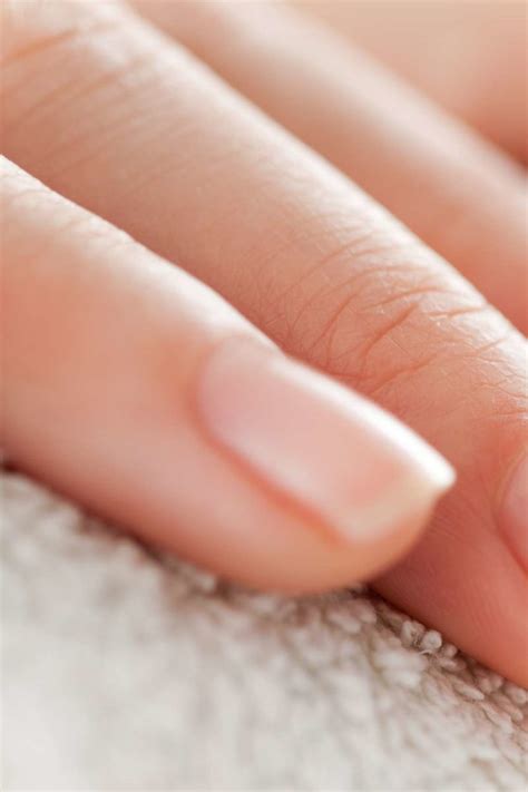 Peeling Nails Causes Treatment And Prevention