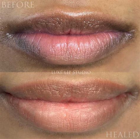 Semi Permanent Makeup Lips Before And After
