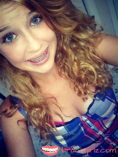 Beautyfull Tooth Braces Girl With Blonde Curly Hair And Deep Blue Eyes