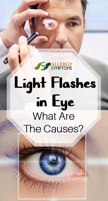 Light Flashes In Eye What Are The Causes A To Sort Flashes In
