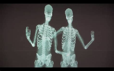 Everything In The Viral Video Of The Skeletons Kissing Behind An X Ray