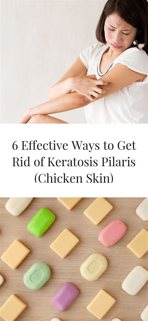 6 Effective Ways To Get Rid Of Keratosis Pilaris Chicken Skin Brown