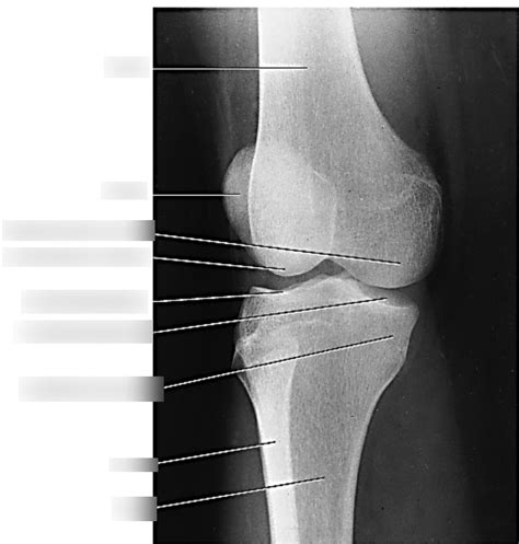 Ap Oblique Lateral Knee Anatomy Diagram Quizlet