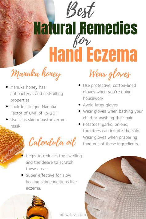 How To Use Manuka Honey For Eczema And Cure It Naturally Eczema