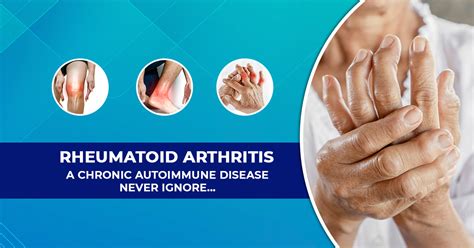 Rheumatoid Arthritis Ra Types Symptoms Causes Effects And