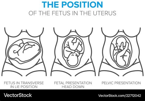 Position Of The Fetus In The Womb Royalty Free Vector Image