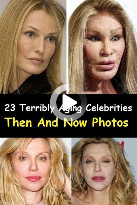 10 Hollywood Celebrities Whose Plastic Surgery Caused Them A Lifetime