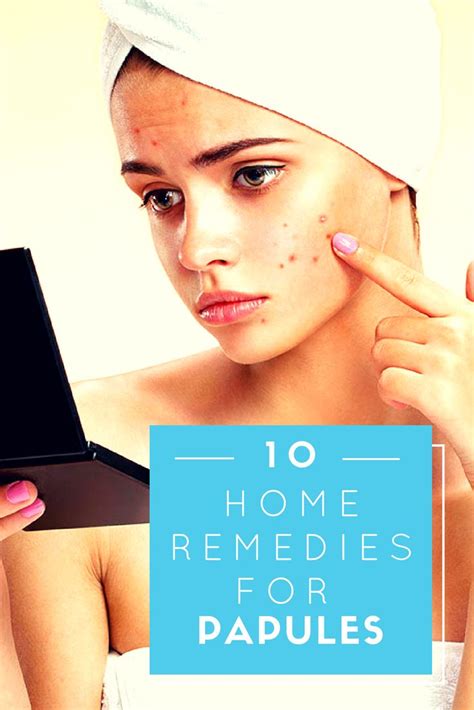 Home Remedies For Papules Home Remedies For Acne Natural Acne