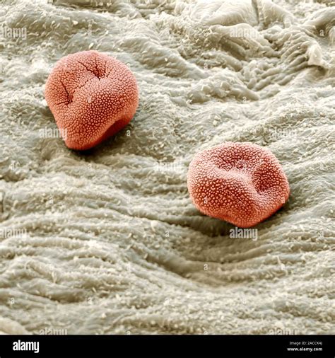 Rust Fungus Spores Coloured Scanning Electron Micrograph Sem Of Two