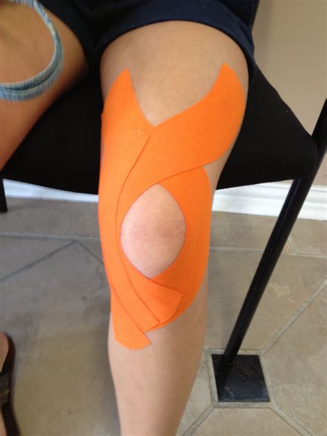How To Apply Kt Tape To Knee For Arthritis Inspire Referances
