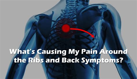What Causes Pain Around The Ribs And Back Symptoms How Can This Be