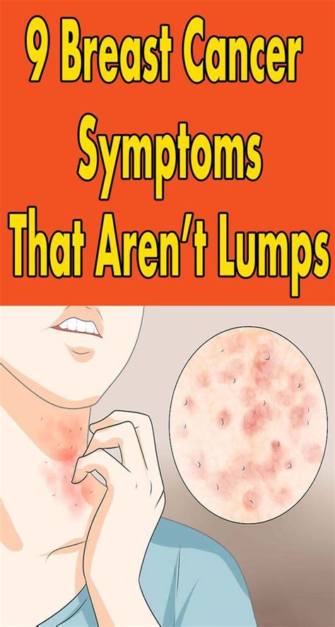 Breast Cancer Symptoms That Arent Lumps Sweet Oh Joy