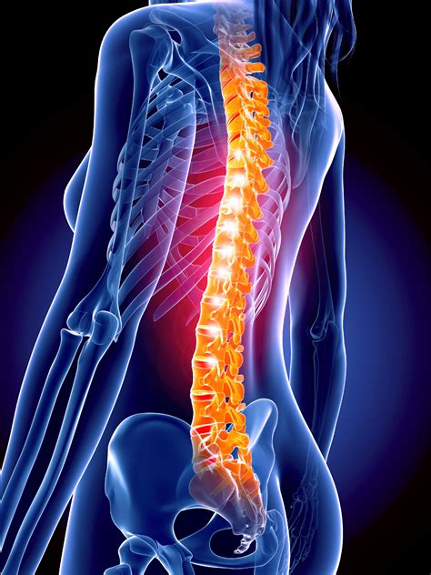 dolor en la columna media Cuándo al médico por un dolor de espalda