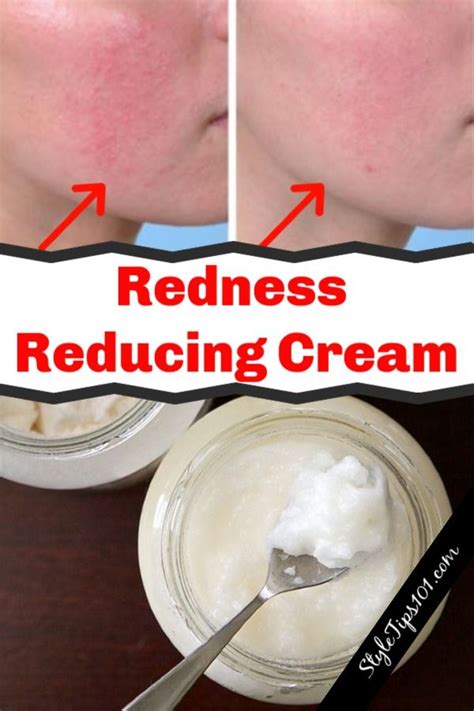 Diy Redness Reducing Cream Eye Cream Reduce Face Redness Skin Care