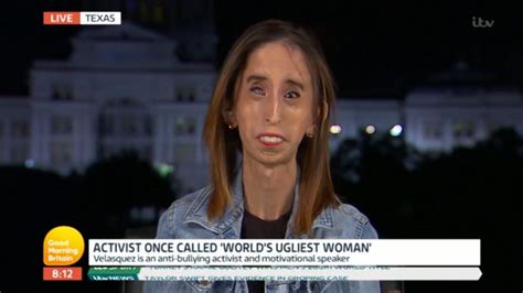 World S Ugliest Woman Lizzie Velasquez Speaks Out About Bullying