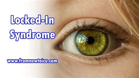 What Is Locked In Syndrome — From New To Icu Locked In Syndrome Nurse Lock