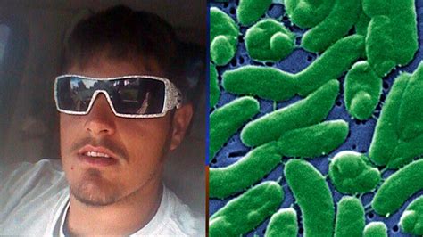 Swimmer Dies After Contracting Rare Flesh Eating Bacteria Off Florida